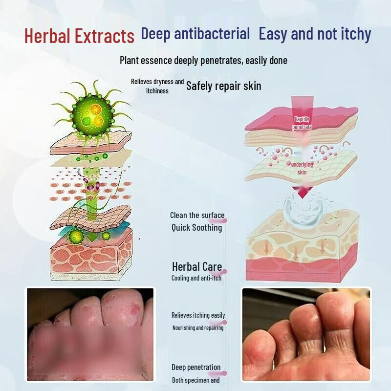 Yunnan Baiyao Athlete's Foot Spray