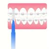 Pencil-style Interdental Brush Oral Interdental Brush I-shaped Straight Bracket Interdental Brush 30pcs/box