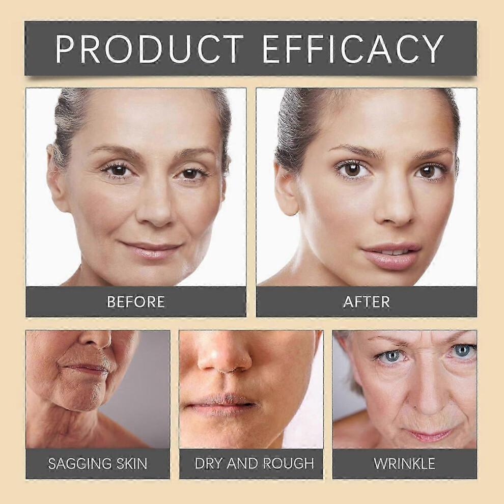 Anti-wrinkle Cream with Bee Venom: Firms, Tightens and Moisturizes for All Skin Types