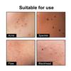 Hoygi Cute Black Acne Patch, Reduces Spots, Blackheads, Acne, Lightens Pimples, Balances Tone, Acne Patch