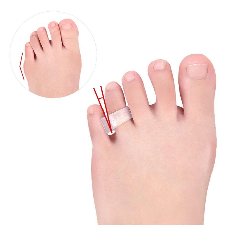 Toe Splitter Thumb Valgus Device Can Wear Shoes Silicone Big Toe Valgus Toe Splitter Anti-wear Men and Women