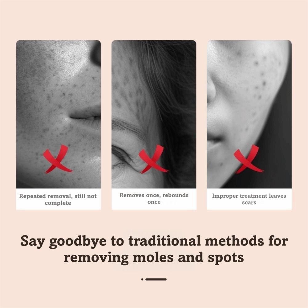 Portable Spot Removal Pen Facial Skin Care Freckle Improvement Device Skin Care Device Salon Use