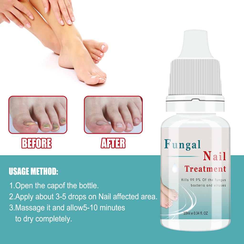 Nail Care Solution, Nail And Toe Care Solution, For Skin Care Nail Nourishing, Fungal Nail Liquid 10ml