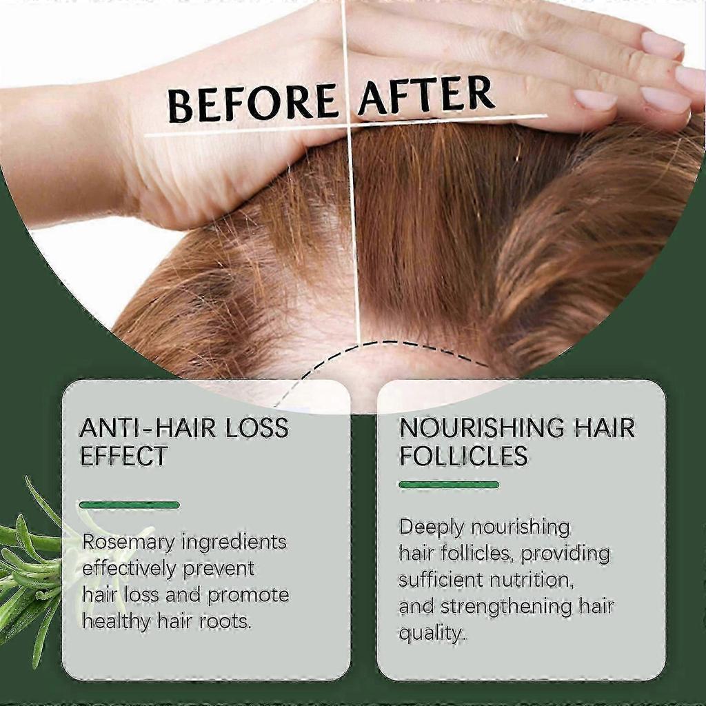 New model OUHOE Rosemary Soft Hair Care Oil Nourishes hair follicles, strengthens hair, makes it smooth, plump and shiny, and provides hair care essen