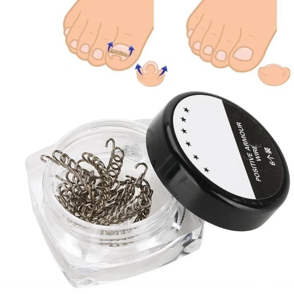 10 Pcs/box Ingrown Toenails Correction Wire Corrector Foot Pedicure Tool Toenail Correction Wires Paronychia Recover