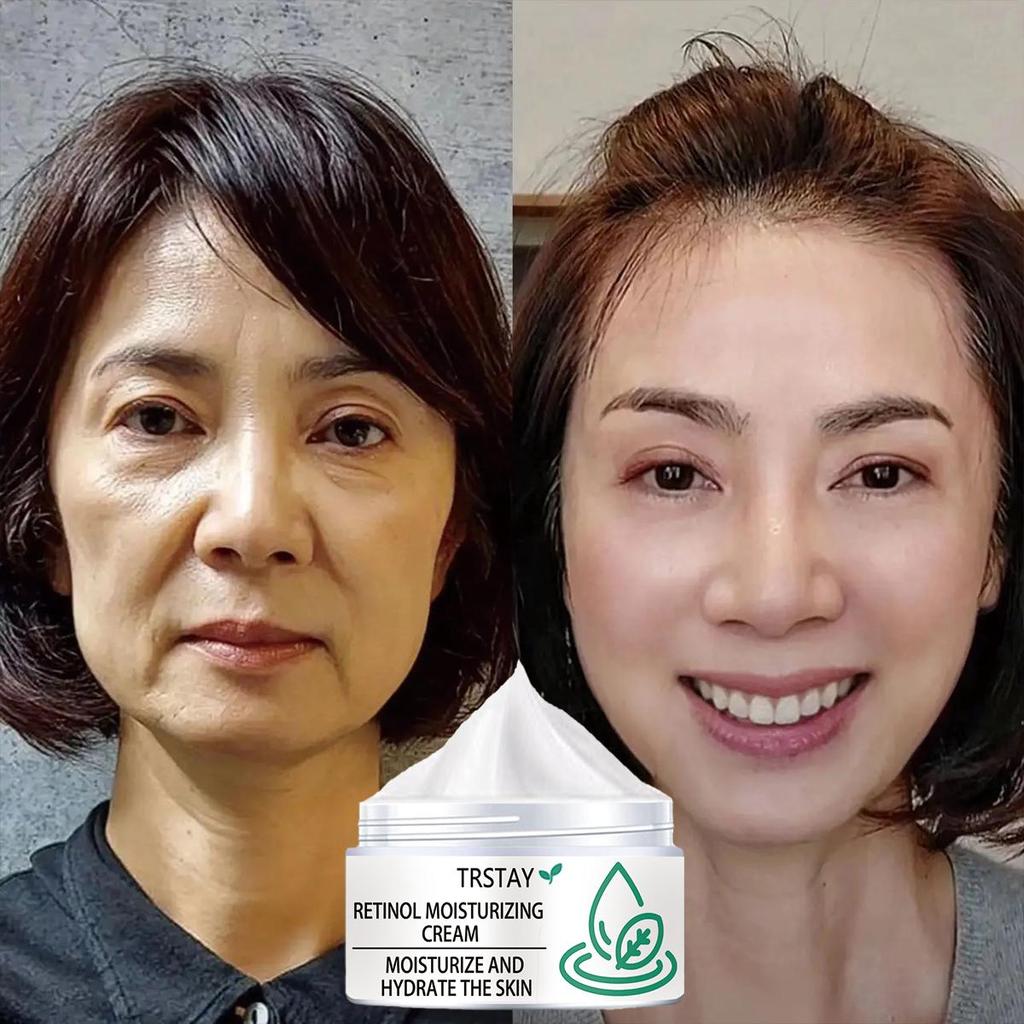 Retinol Instant Wrinkles Removal Face Cream Anti-aging Anti-Wrinkle Firming Lifting Facial Cream Fade Fine Line Facial Care