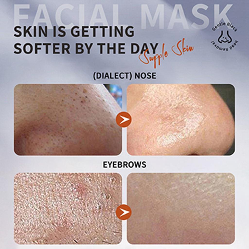 Blackhead Remover Mask Set, Charcoal Peel-Off Mask, Deep Cleansing For Face, Nose, Blackheads, Acne, Suitable For All Skin Types