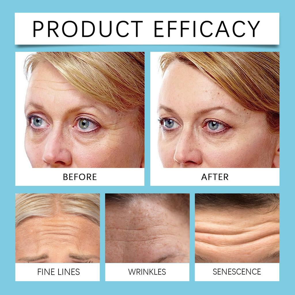 Ouhoe Forehead Repair Patches Gentle Moisturizing Skin Firming And Elasticity Improvement