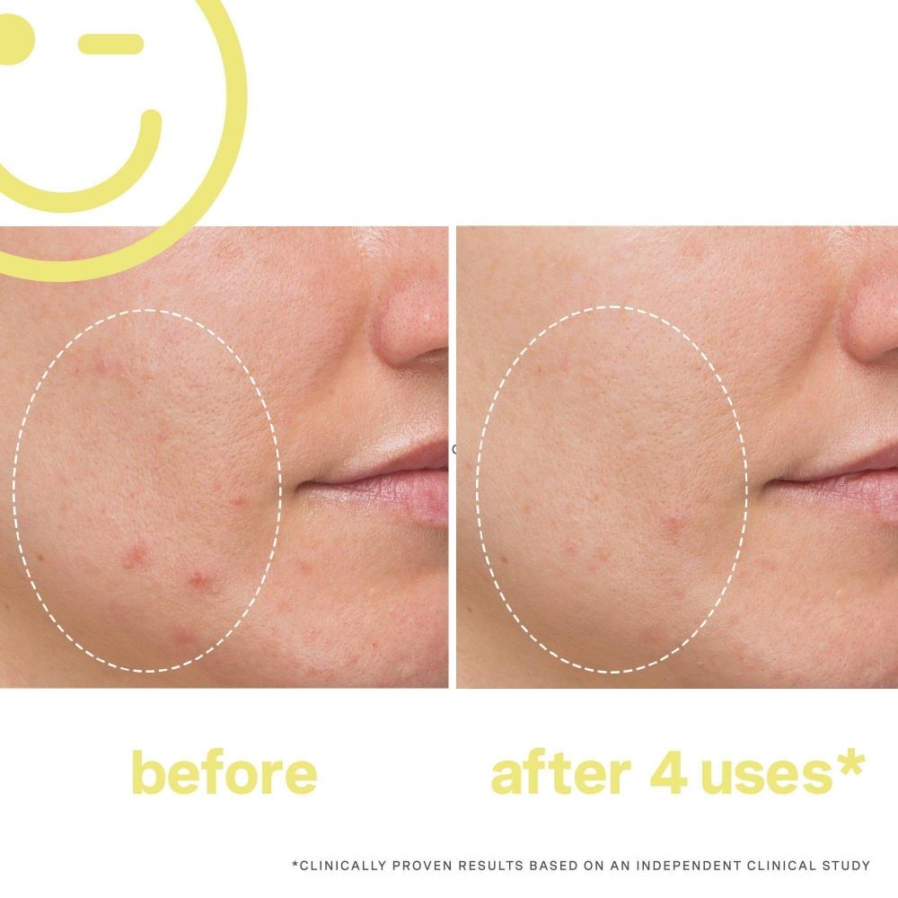 Kate Somerville Mega C 30 Vitamin C Brightening faCial 2.0 Oz