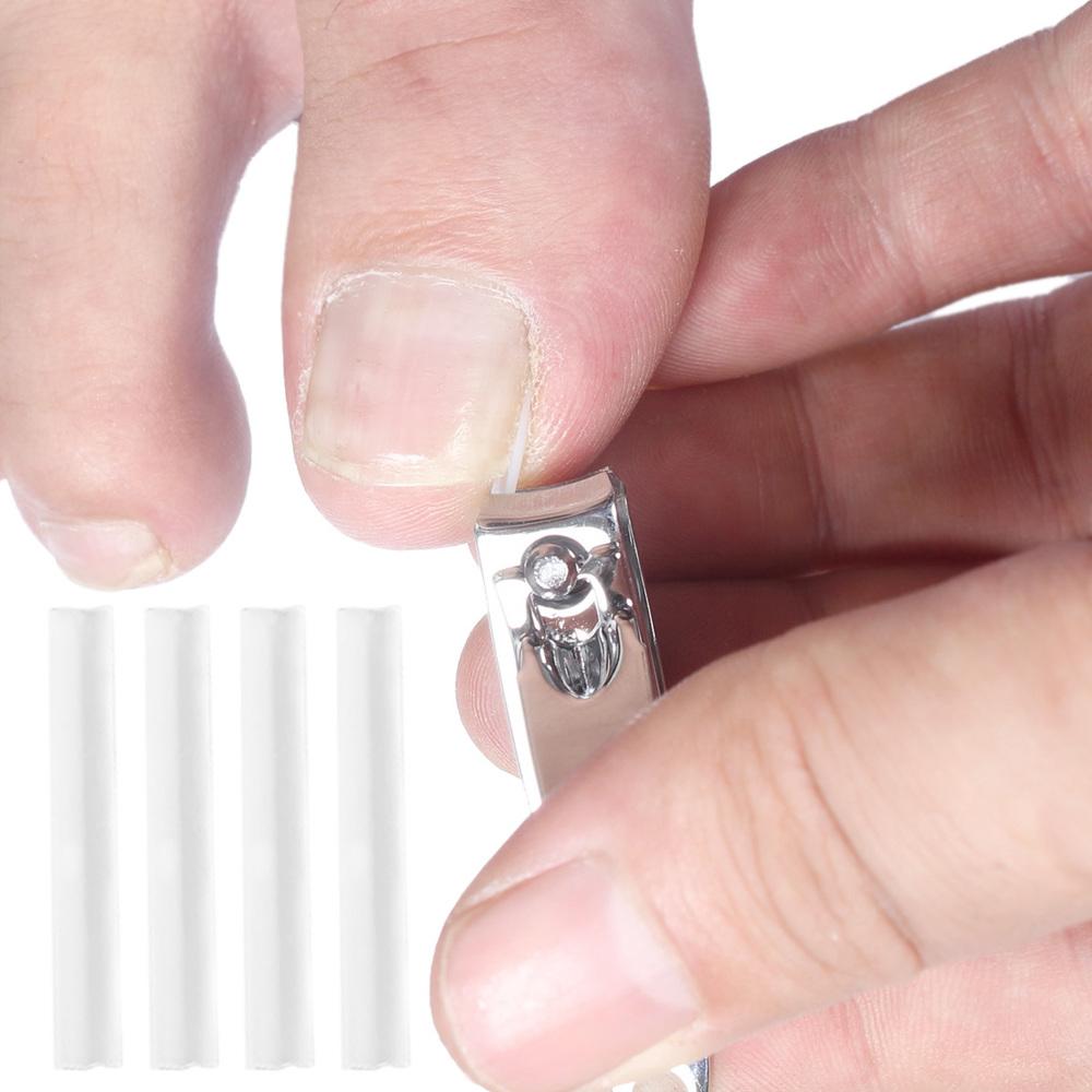 Toenail Correction Tool Toe Nail Treatment Elastic Patch Sticker Straightening Clip Brace Pedicure Tool