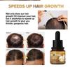 Biotin Hair Growth Oil for Hair Growth and Healthy Scalp, Pre Wash Scalp & Hair Oil Infused with Biotin, Strengthening, Nourishing & Volumizing