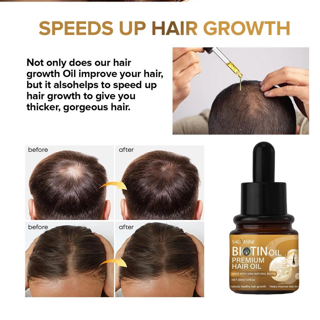 Biotin Hair Growth Oil for Hair Growth and Healthy Scalp, Pre Wash Scalp & Hair Oil Infused with Biotin, Strengthening, Nourishing & Volumizing