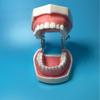 Dental Resin Teeth Model for Oral Instrument Practice: Implants, Extracted Teeth, Root Canal, and Gingival Retraction.