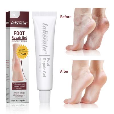 Foot Crack Cream, Autumn and Winter Heel Anti-crack, Moisturizing Foot Gel, Deep Care, Hydrating and Exfoliating