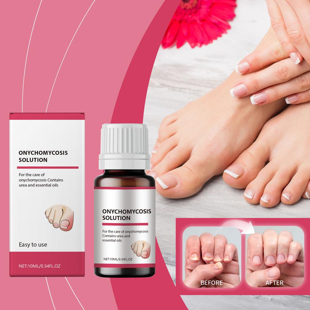 Weich und Dick, Stärkt die Nägel, Spendet der Haut um die Nägel Feuchtigkeit, 10ML