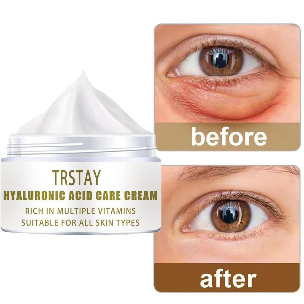 The wrinkle-smoothing cream is gentle and non-irritating, smoothing wrinkles, lightening fine lines and leaving skin soft and refined