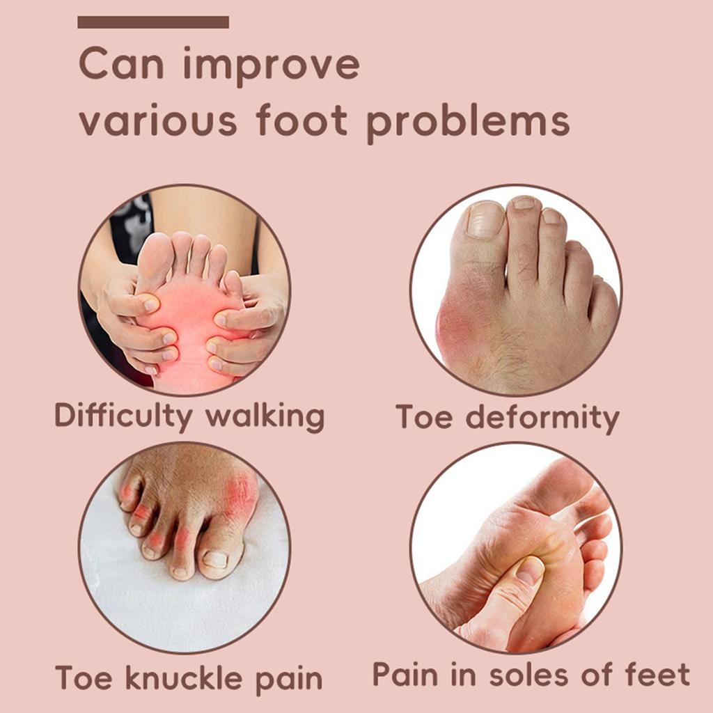 The Toe Corrector Is Suitable For Both Men And Women, Providing Pain Relief For Hallux Valgus. It Is Comfortable And Breathable.