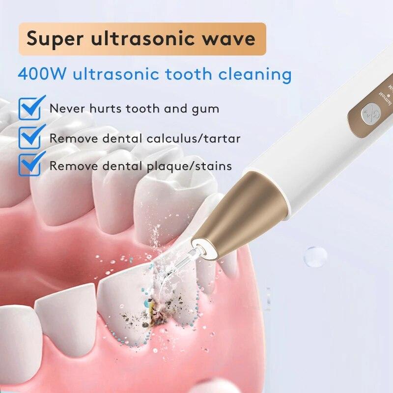 Ultraschall Dental Scaler Für Zähne Zahnstein Fleck Zahn Zahnstein Entferner Elektrische Sonic Zähne Plaque Reiniger Zahnstein Entfernung
