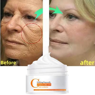 Whitening Cream Hyaluronsäure-Creme Feuchtigkeitsspendende, Anti-Falten-, Anti-Oxidations-, strahlend glatte Creme