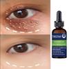 5ML/15ML/30ML/50ML/Eye Essence The Latest Hyaluronic Acid Essence Skin Care Deep Facial Anti-aging