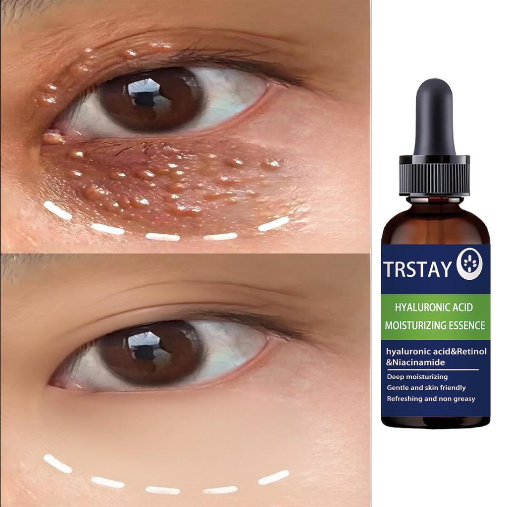 5ML/15ML/30ML/50ML/Eye Essence The Latest Hyaluronic Acid Essence Skin Care Deep Facial Anti-aging