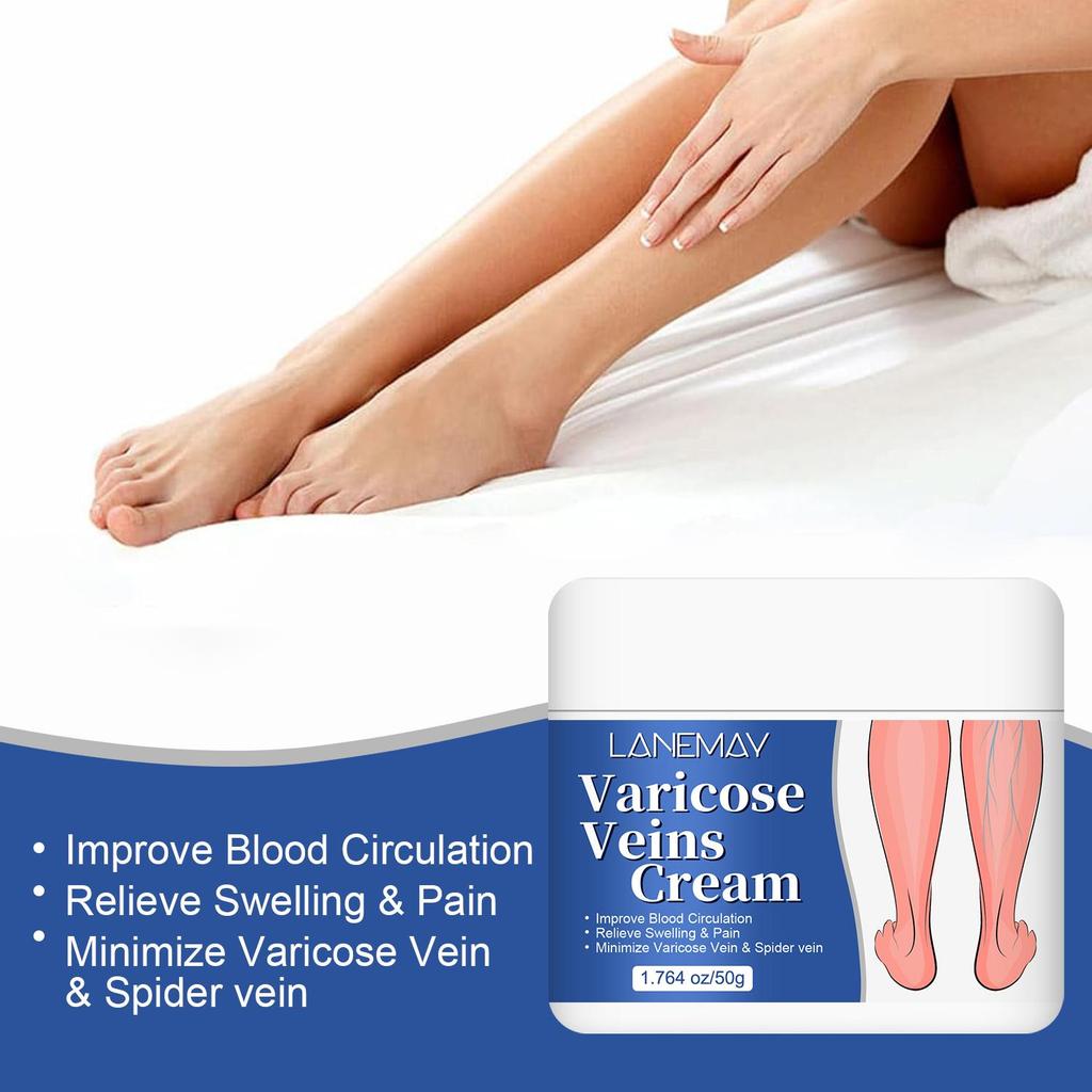 Varicose Veins Cream-Improve Blood Circulation-Relief Swelling And Pain-Minimize Varicose Vein & Spider Vein, 50g