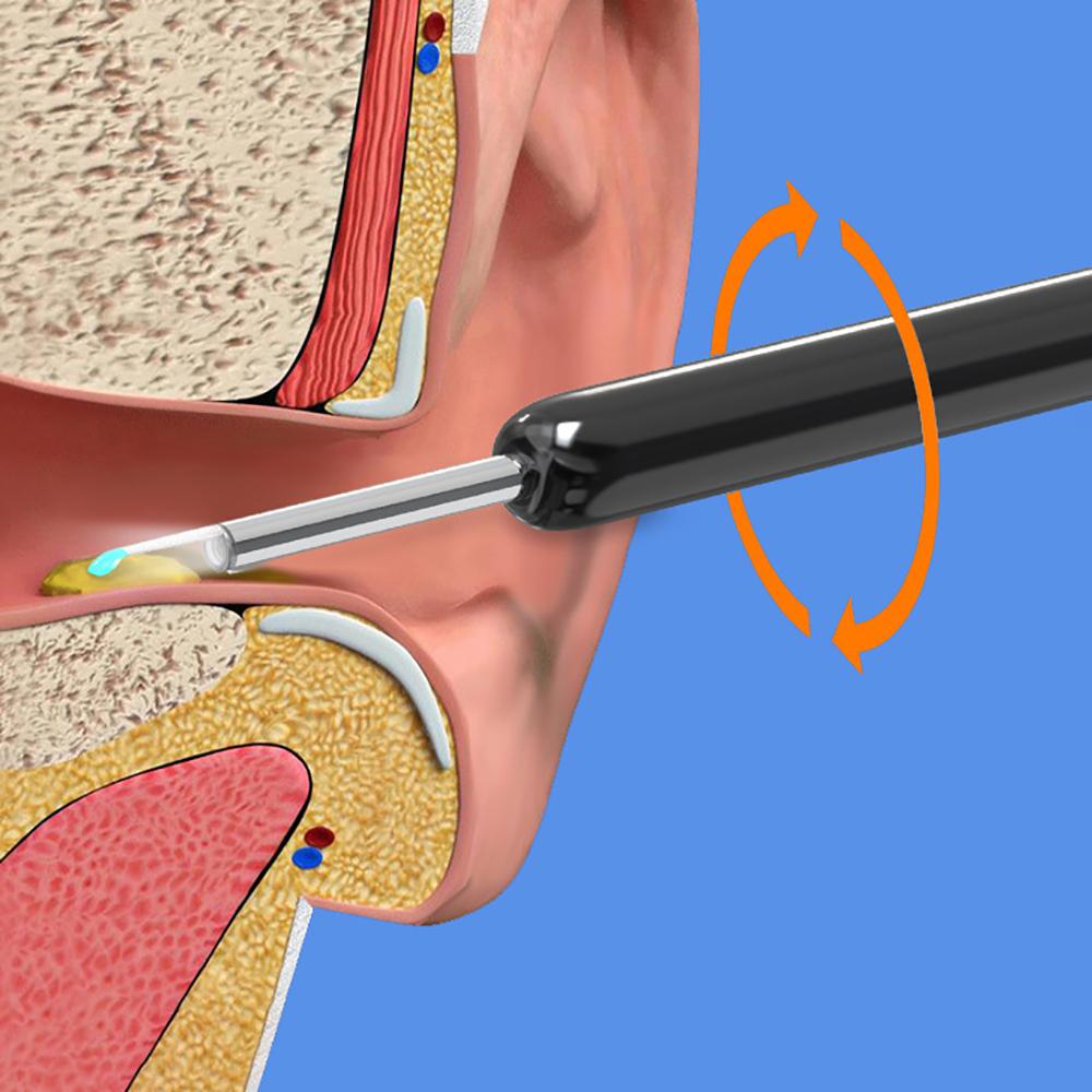 WiFi Visible Wax Elimination Spoon USB HD Load Otoscope Cleaner Removal