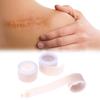 Silicone Scar Patch 50/100/150cm - Waterproof Self-Adhesive Keloid Removal Strip For Surgical Acne Burn