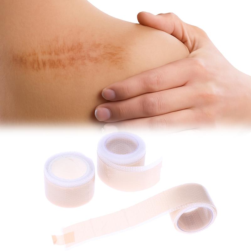 Silicone Scar Patch 50/100/150cm - Waterproof Self-Adhesive Keloid Removal Strip For Surgical Acne Burn