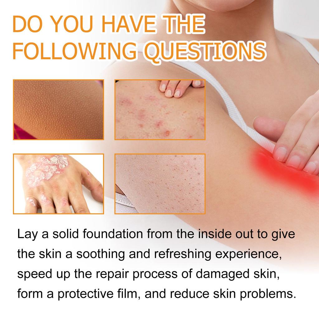 South Moon Skin Repair Spray Relieves Discomfort Nourishes Smooths Skin Care