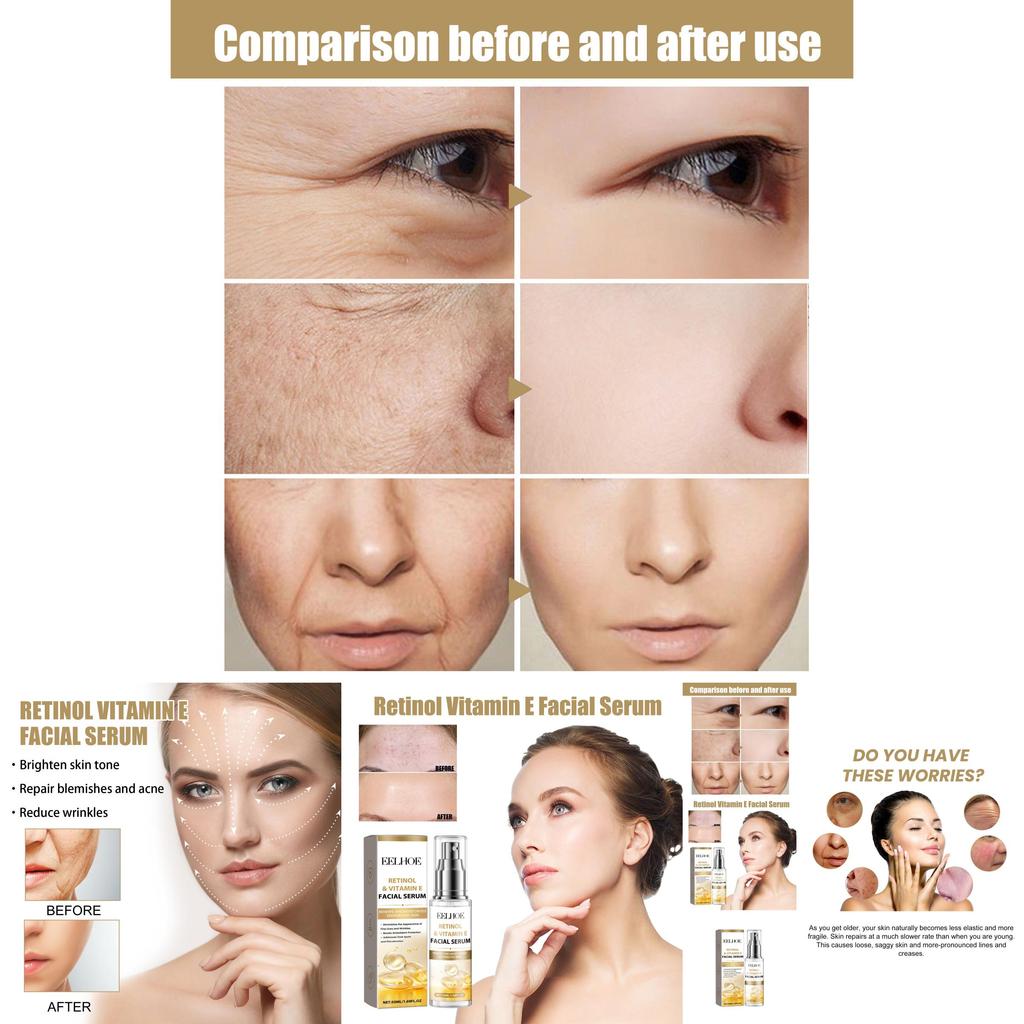 Eelhoe Retinol Vitamin E Night Facial Serum For Radiant Skin Hydrating Brightening Essence