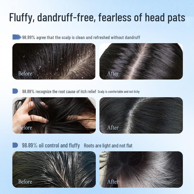 Three Magicians Selenium Disulfide Anti-Dandruff Shampoo