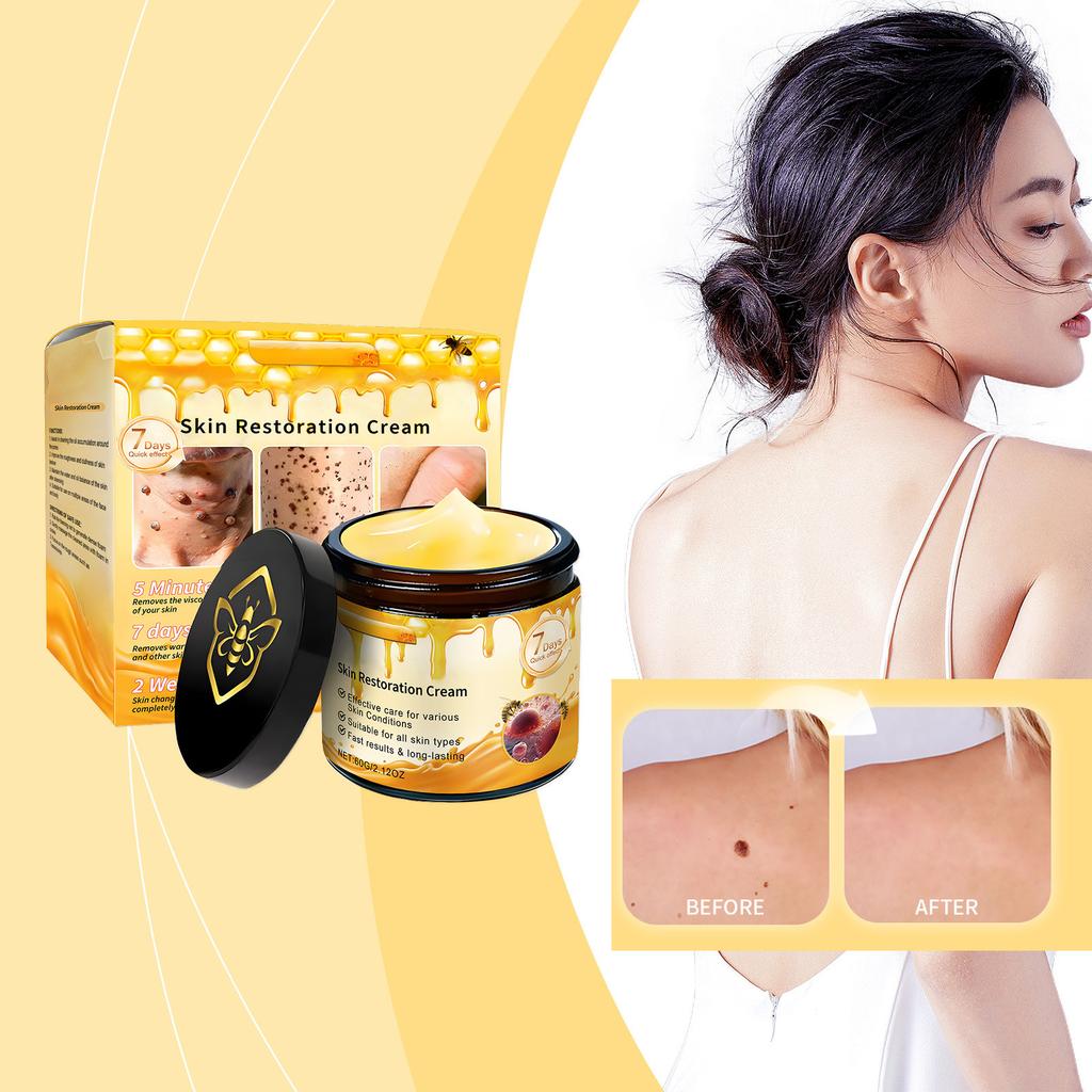 The Skin Cream For Removing s, Combined With Herbal Ingredients, Can Remove s Without Leaving Scar.