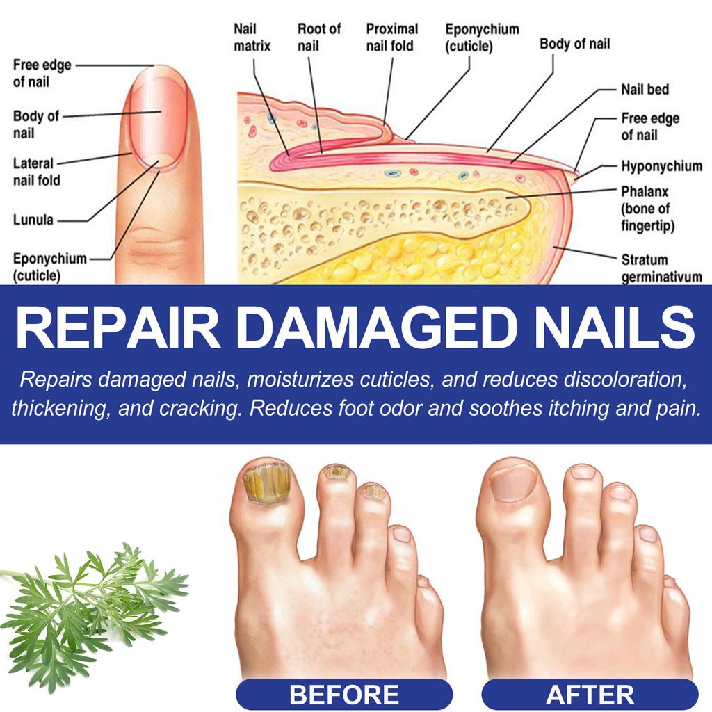 Ximonth Foot Care Pack With Nourishing Ingredients For Softened Skin And Callus Repair