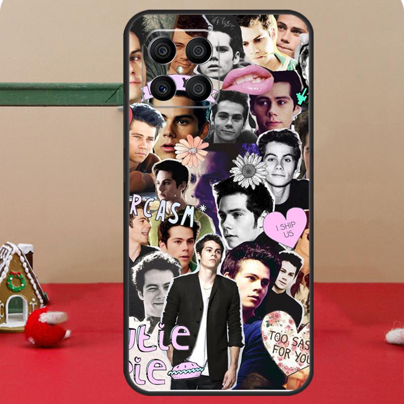Dylan O'Brien Collage Teen Wolf Case For Honor Magic 8 Pro 6 7 Lite Honor 400 200 50 70 X8c X8b X9a X9b X9c X9d Win RT Coque
