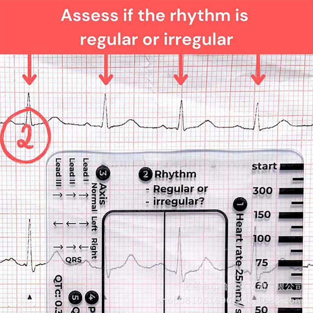 Electrocardiogram Assessment Tool 7 Step Ruler Card For Hospitals Clinics Healthcare Professional And Medicals Students