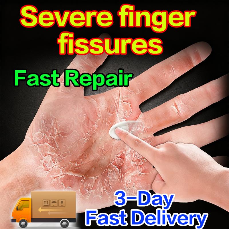 Clinical Hand Cream for Intensive Cracked Skin Repair