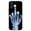 For Honor X60i Case Soft Silicone TPU Cat Lion Fashion Back Cover for Huawei Honor X60i 5G Cases HonorX60i Shockproof Cartoon