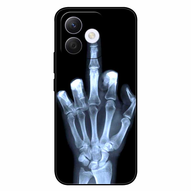 For Honor X60i Case Soft Silicone TPU Cat Lion Fashion Back Cover for Huawei Honor X60i 5G Cases HonorX60i Shockproof Cartoon
