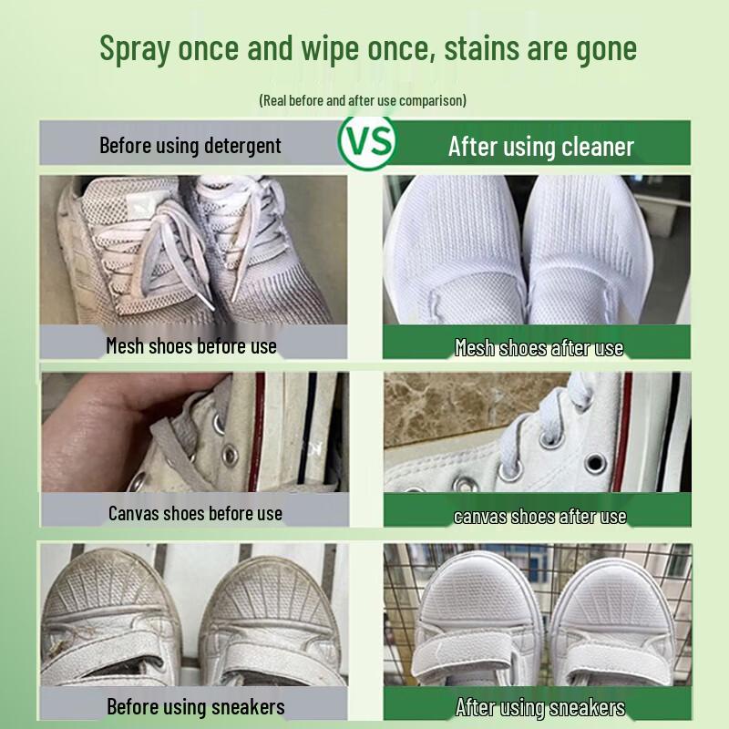 Kit de Limpeza de Sapatos Brancos