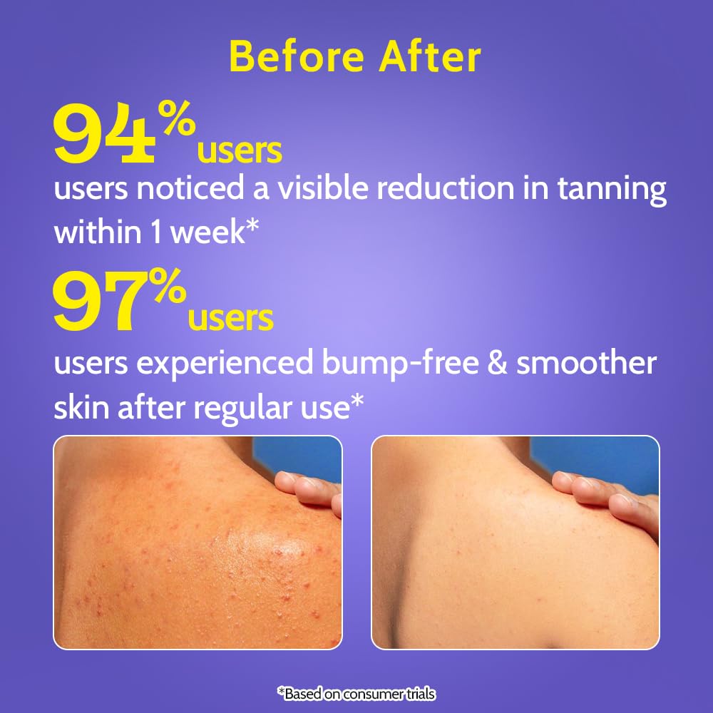 Chemist At Play 1% Salicylsäure Peeling Körperwäsche 473ml Sanftes Duschgel für Männer & Frauen