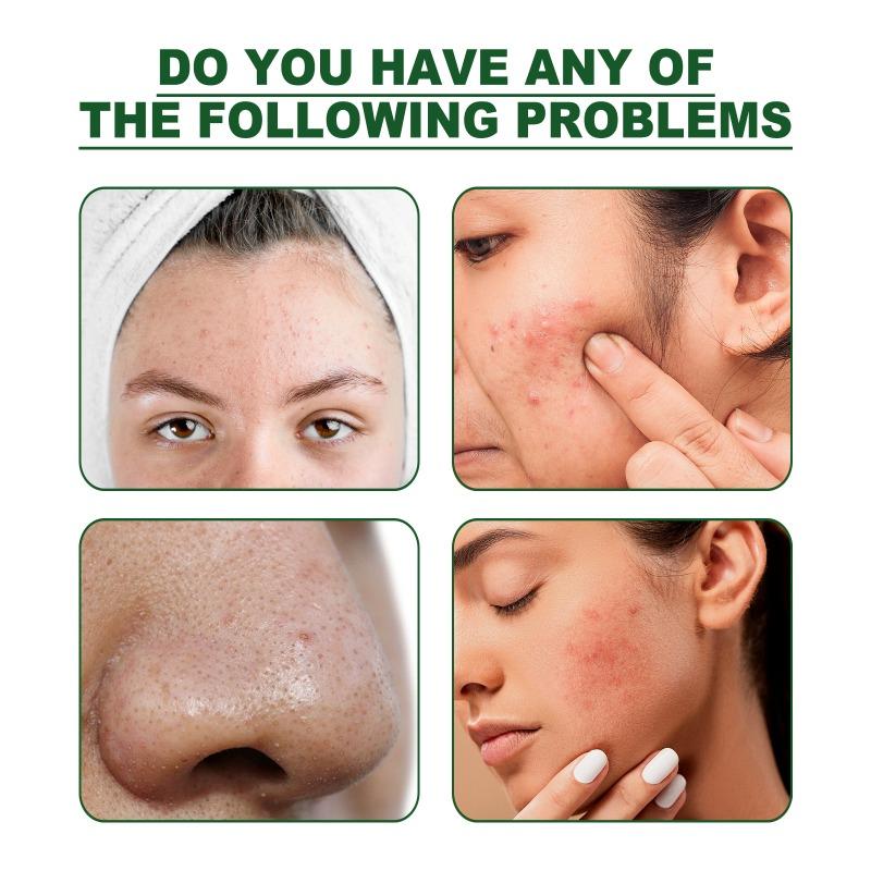 Green Tea Mask for Deep Skin Cleansing, Apply The Mask Stick To Remove Blackheads and Shrink Fine Pores