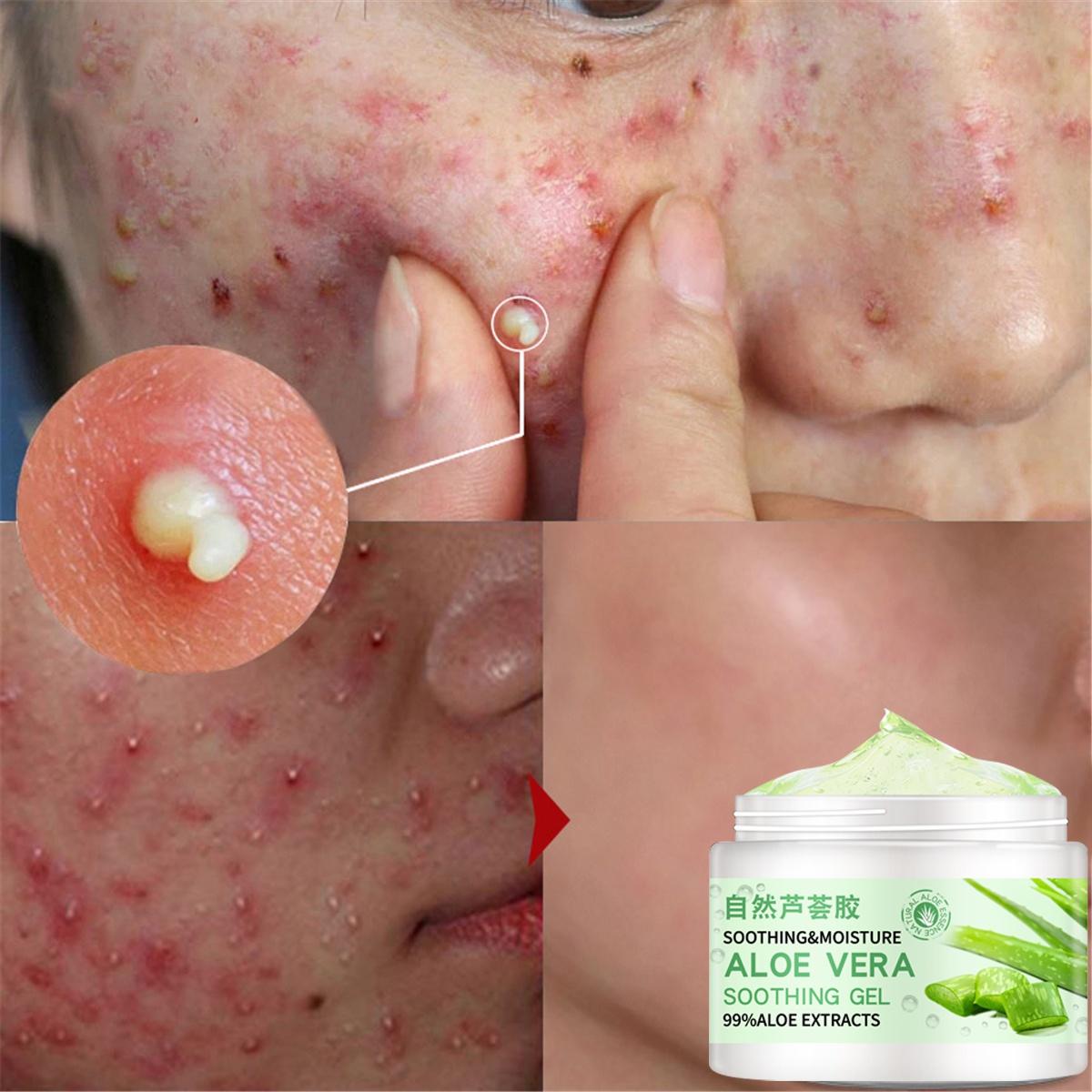 aloe vera gel hair styling Styling Gel main image 1