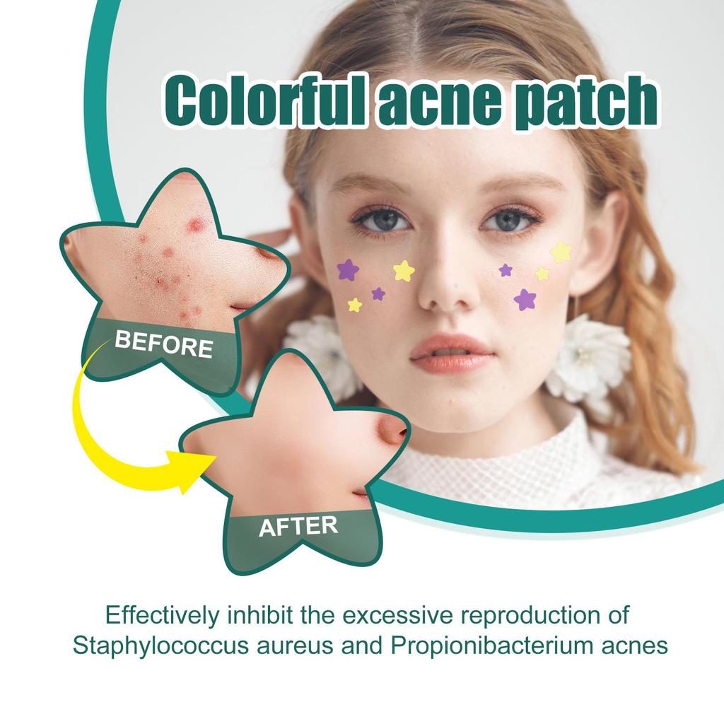 112pcs Acne Pimple Patch / Acne Treatment Stickers / Pimple Remover/Blemish Spot Face Skin Care