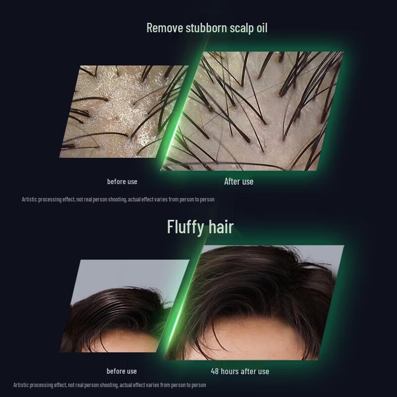 Clear Men Anti-Dandruff & Oil Control Shampoo Set