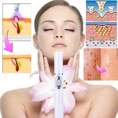 Akne Falten Entfernung Laser Stift Haut Flecken Entfernung Anti Radiergummi Behandlung Tragbare Blau Licht Therapie