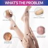 Cream Leg Swelling Relief Eliminate Vasculitis Phlebitis Improve  Spider Veins Soothing Cream