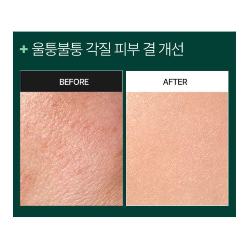 MEDI-PEEL Phyto Cica-Nol B5 Shot Serum 6000 Intensive Calming Repair Ampoule with Centella & Panthenol 50g