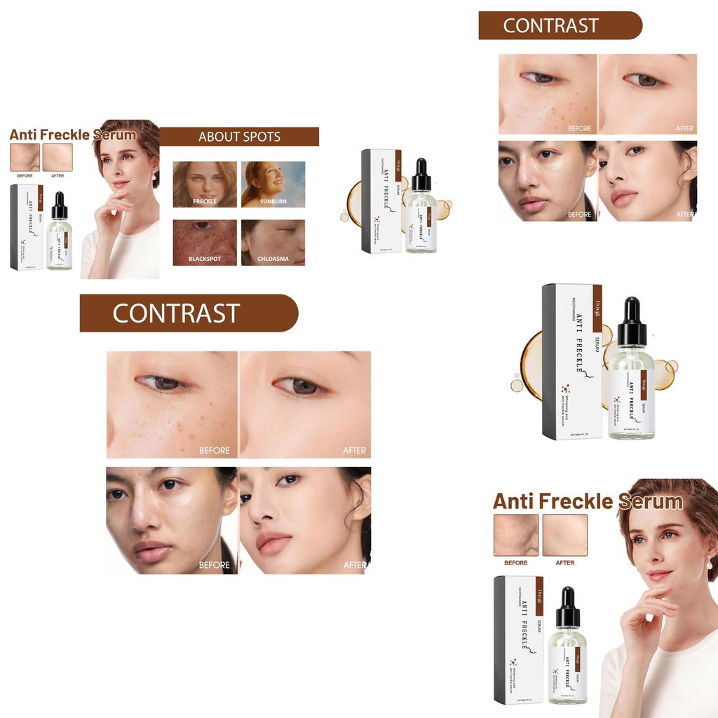 Hoygi Niacinamide Spot Brightening Serum Hydrating And Nourishing Skin Treatment For Dark Spots And Dull Complexion