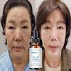 5G/15G/30G/50G/TRSTAY Vitamin C For Face Cream Pigments Dark Spots Removal Whitening Facial Cream Lightening Skin Care Products Beauty Health